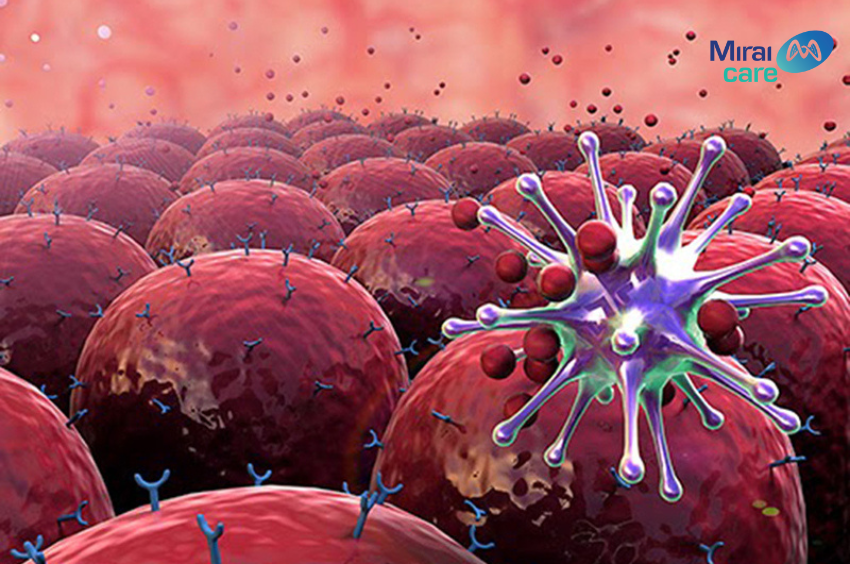 Tế bào NK trong điều trị ung thư vú