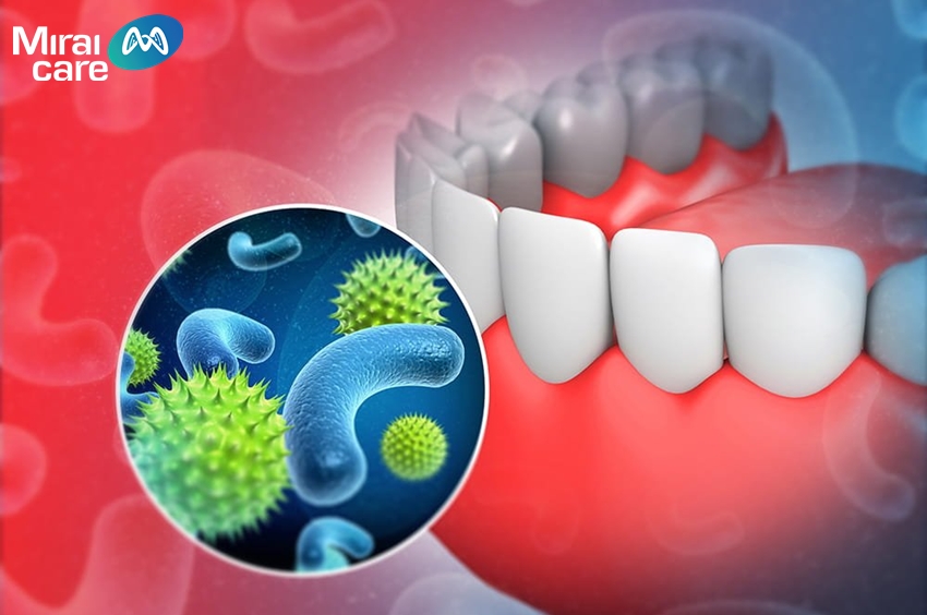 Các vi khuẩn trong miệng không chỉ sống đơn thuần ở khoang miệng