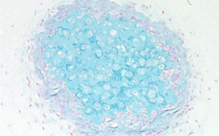  Mô sụn được tạo ra nhờ sử dụng tế bào iPS (Hình ảnh cung cấp từ Đại học Kyoto) 