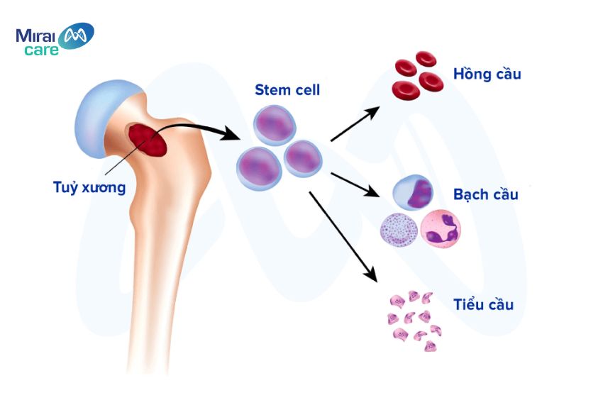 Phương pháp trị liệu tự kỷ bằng tế bào gốc sử dụng chính tế bào tự thân của bé