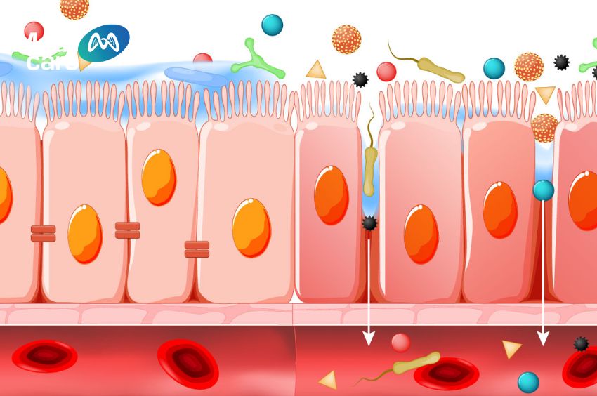 Hội chứng rò rỉ ruột gây viêm nhiễm và kích ứng đường ruột