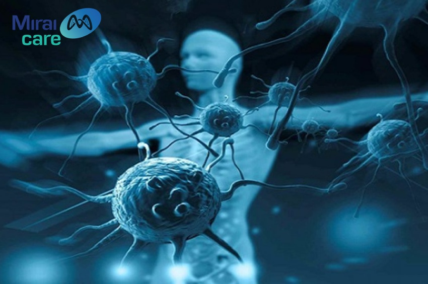 Liệu pháp miễn dịch tế bào NK ứng dụng tế bào vào trong tiêu diệt các khối u