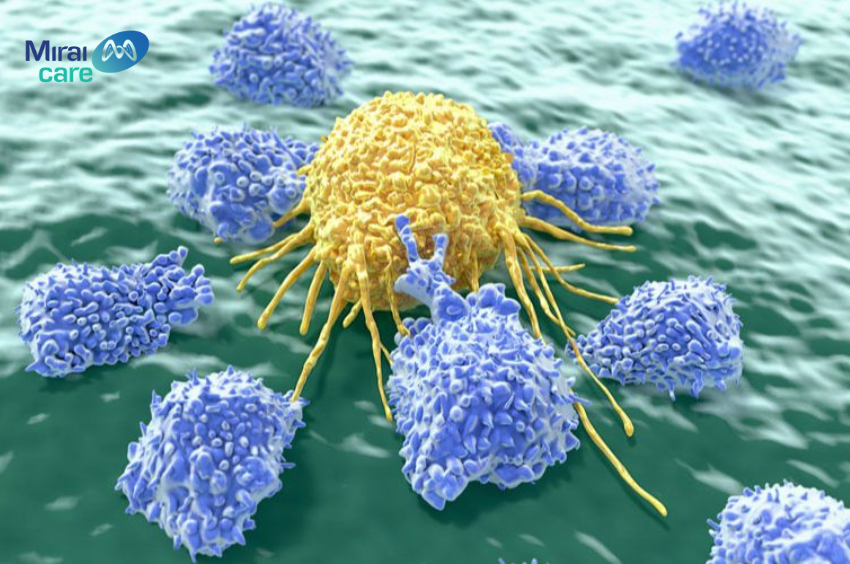 Liệu pháp tế bào NK trong điều trị bệnh viêm khớp như thế nào