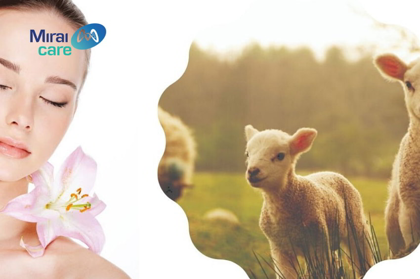 review serum tế bào gốc nhau thai cừu có thực sự hiệu quả