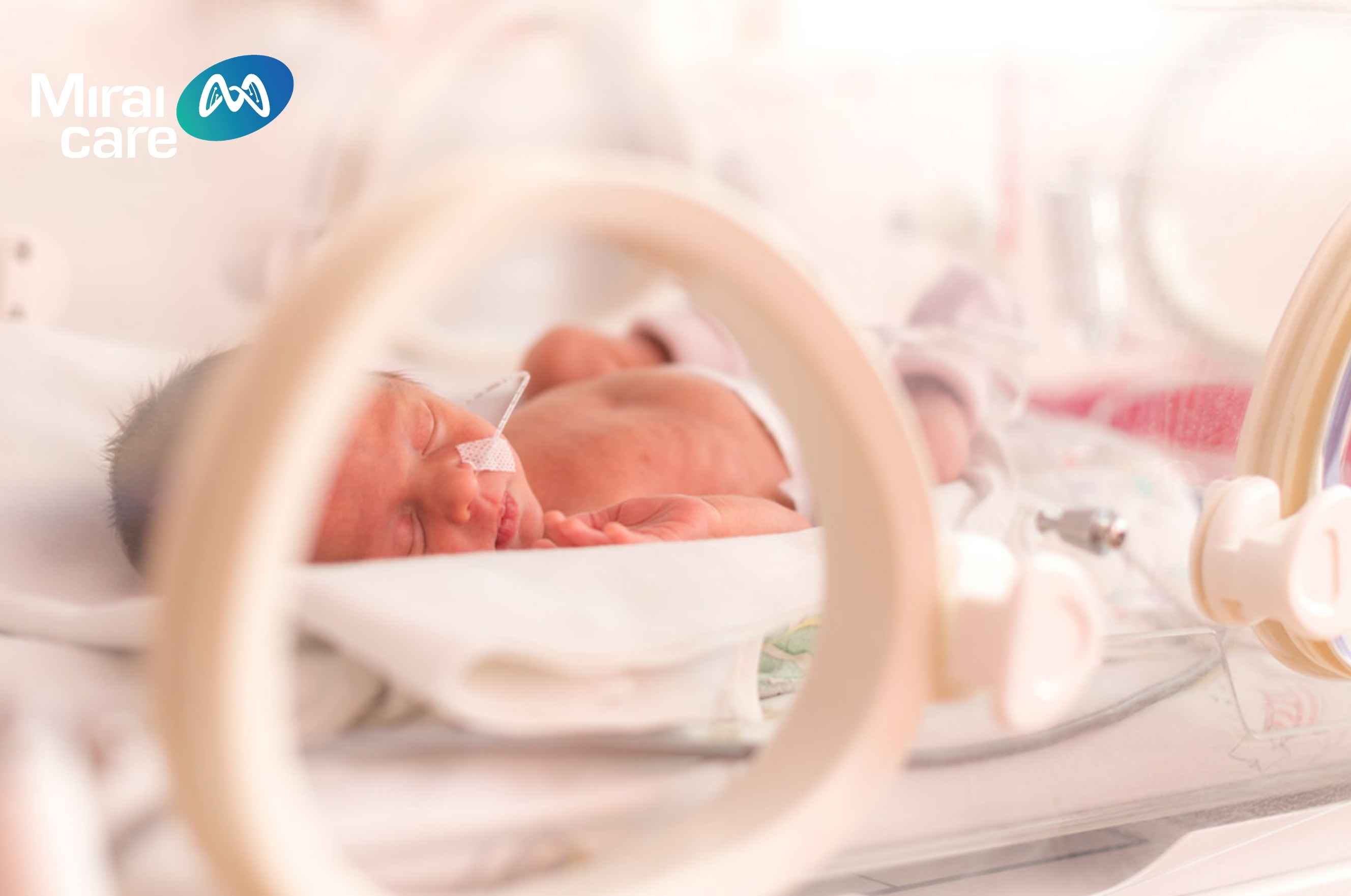 Sinh non cũng là một trong những nguyên nhân dẫn đến việc bị bại não