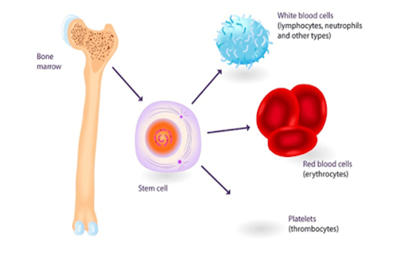 tế bào gốc điều trị đa u tủy xương