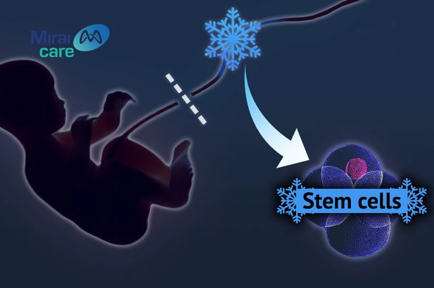 tế bào gốc tạo máu dây rốn