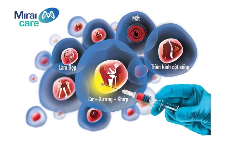tế bào gốc là gì và phần mềm tế bào gốc nhập chữa trị bệnh