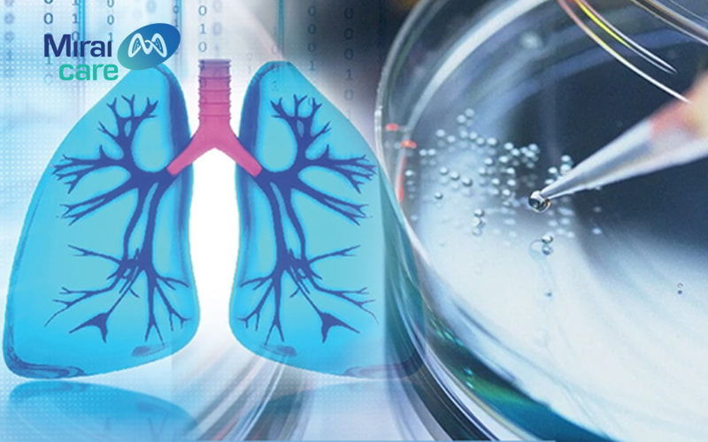 vai trò tế bào gốc điều trị xơ phổi