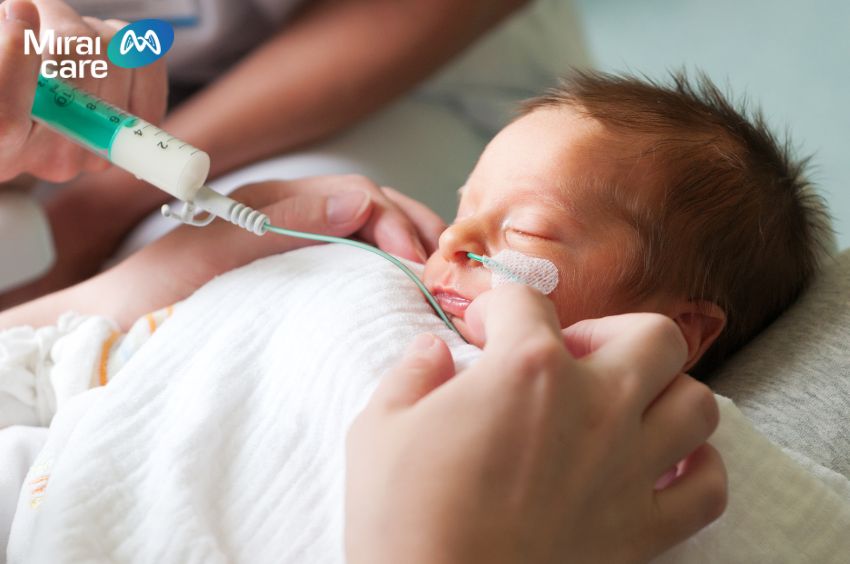 Thiếu oxy khi sinh có thể là nguyên nhân gây ra bại não ở trẻ 