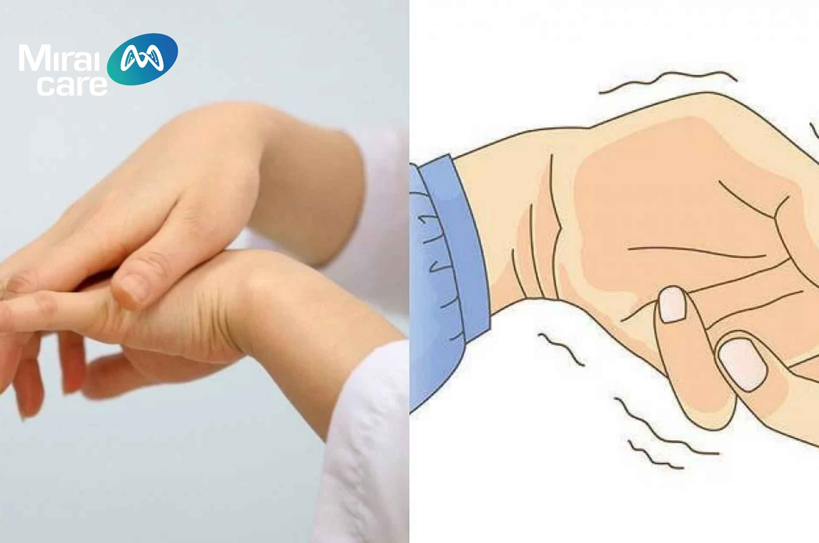 Trẻ bị run khi thực hiện các hoạt động cầm nắm