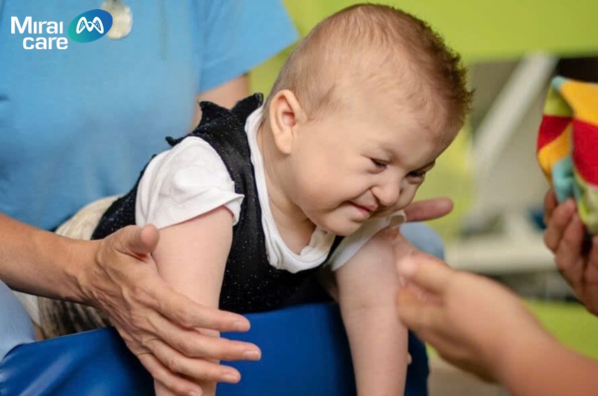 Trẻ em sinh ra bị bại não có thể sống trung bình từ 30 đến 70 năm