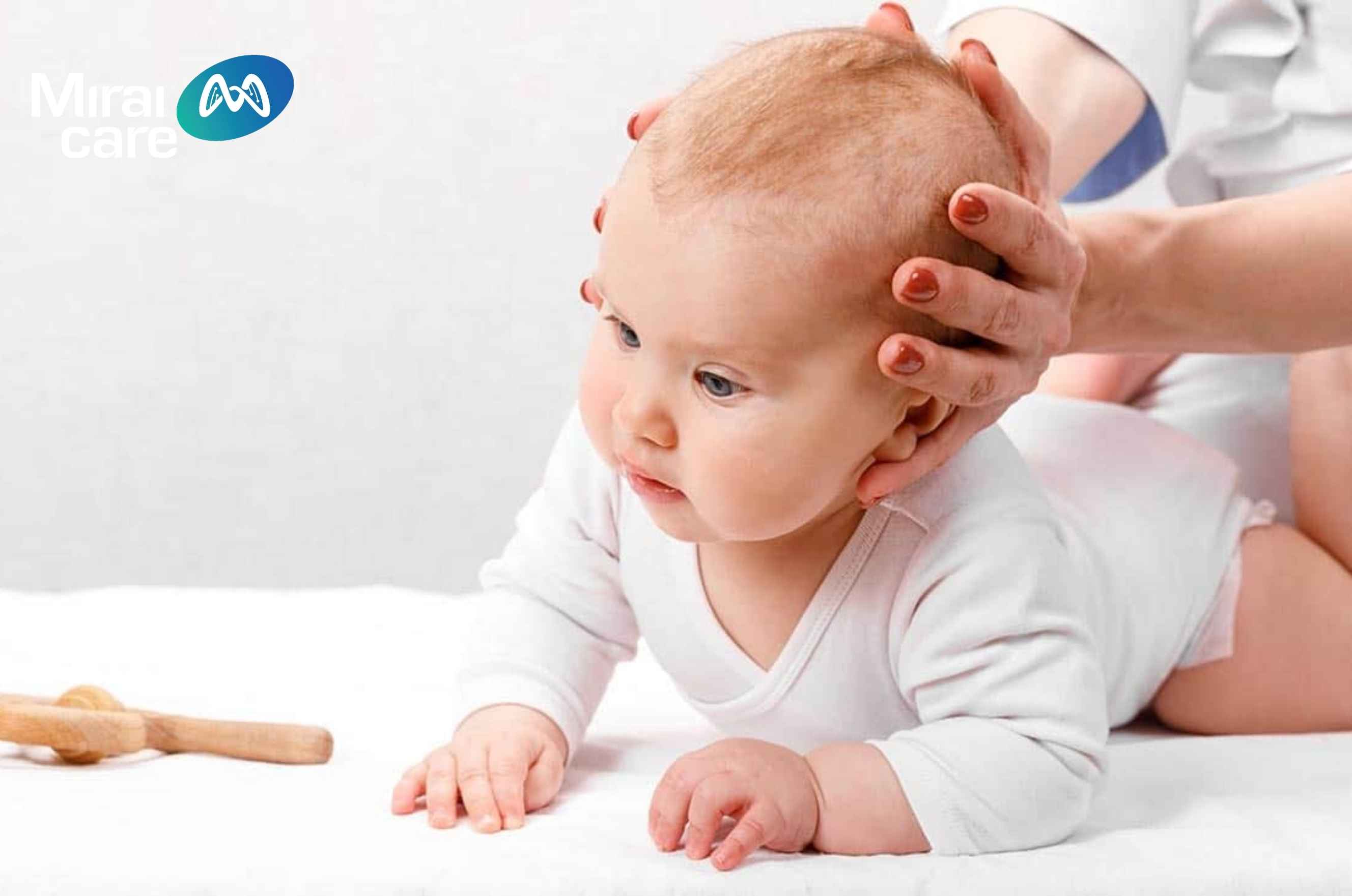 Trẻ khó kiểm soát cổ, đầu thường bị ngả về một bên hoặc không giữ thẳng được