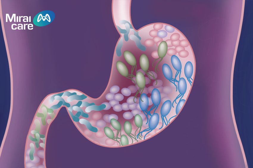 Vi khuẩn đường ruột phát triển mạnh sẽ tiết ra nhiều độc tố ảnh hưởng tới hệ thần kinh trung ương
