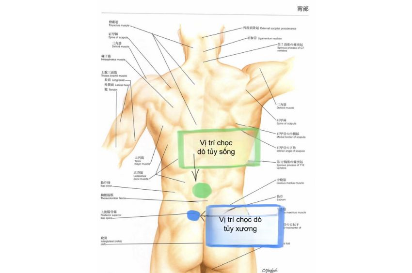 Vị trí chọc dò tủy sống và chọc dò tủy xương