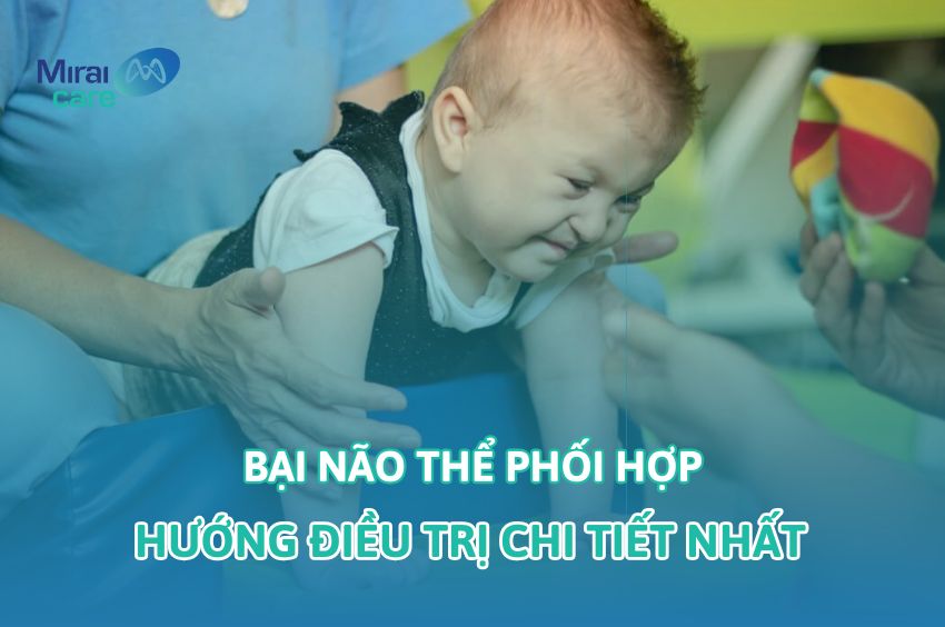 Bại Não