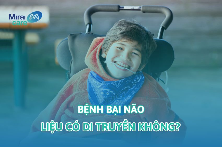 Bại Não