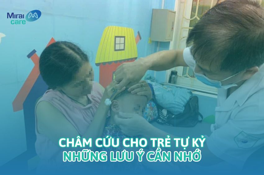 Gợi ý 5 phương pháp châm cứu cho trẻ tự kỷ & Những lưu ý cần nhớ