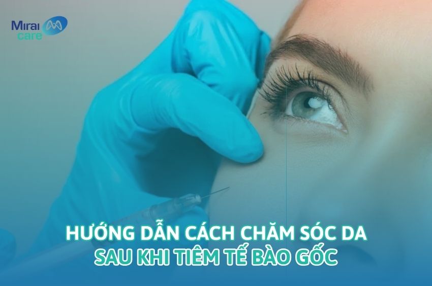 Hướng dẫn c&aacute;ch chăm s&oacute;c da sau khi ti&ecirc;m tế b&agrave;o gốc