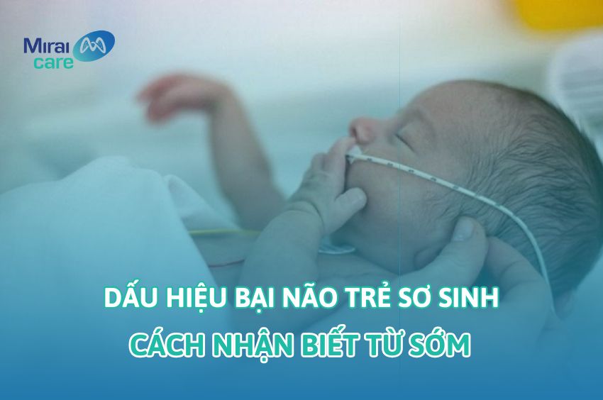8+ Dấu hiệu bại não ở trẻ sơ sinh: Cách nhận biết sớm từ 2 tháng tuổi