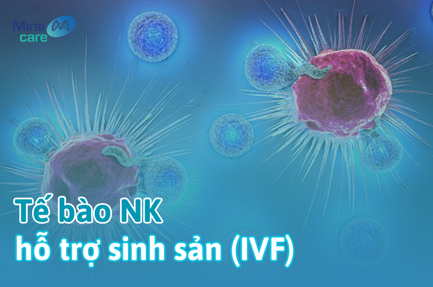 Ứng dụng liệu pháp tế bào nk trong hỗ trợ sinh sản (IVF)