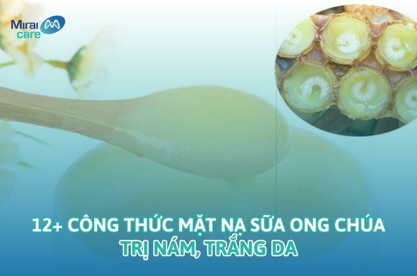 Tự Kỷ