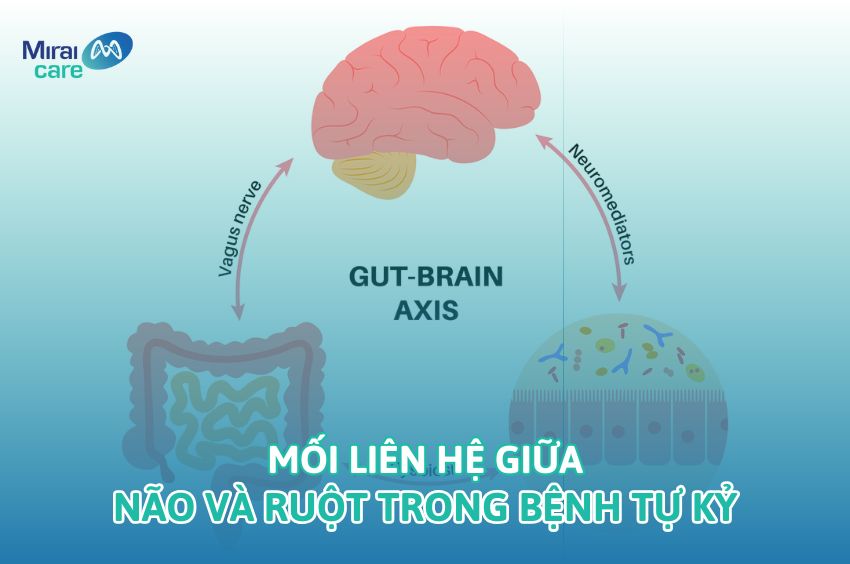 Mối li&ecirc;n hệ giữa n&atilde;o v&agrave; ruột trong bệnh tự kỷ | Cha mẹ n&ecirc;n lưu &yacute;