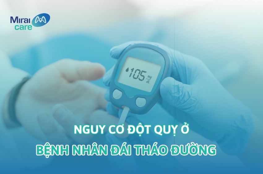 Đột quỵ