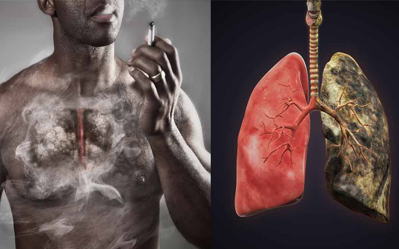Tổng hợp nguyên nhân gây ung thư phổi mà bạn nên cẩn trọng