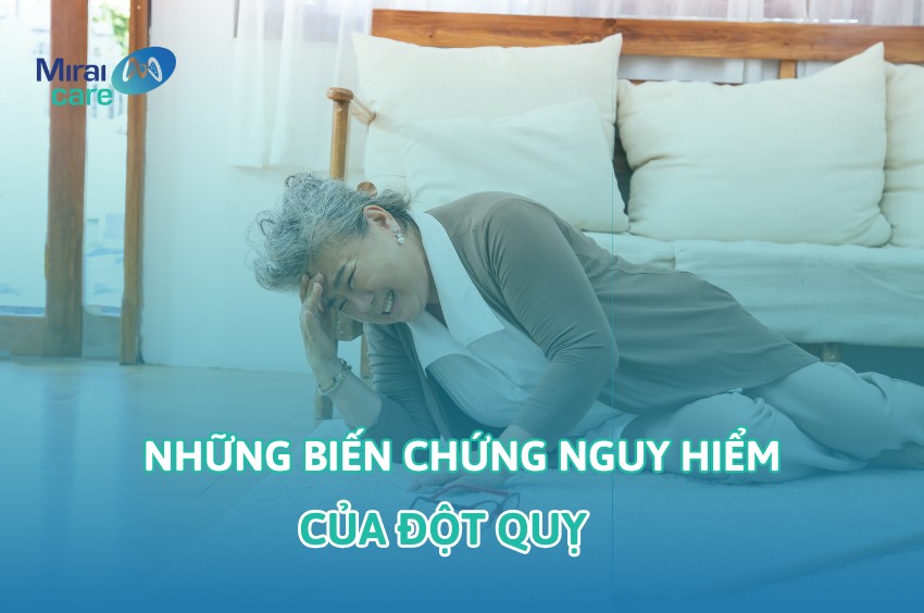 Đột quỵ