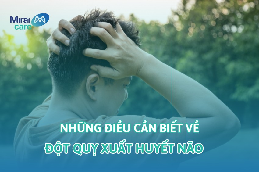 Đột quỵ