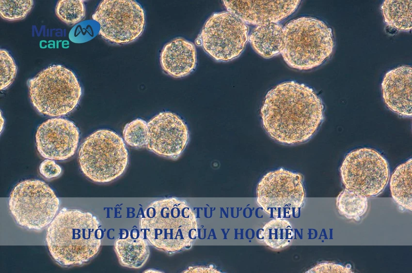 Tế bào gốc từ nước tiểu - Bước đột phá trong y học tái tạo