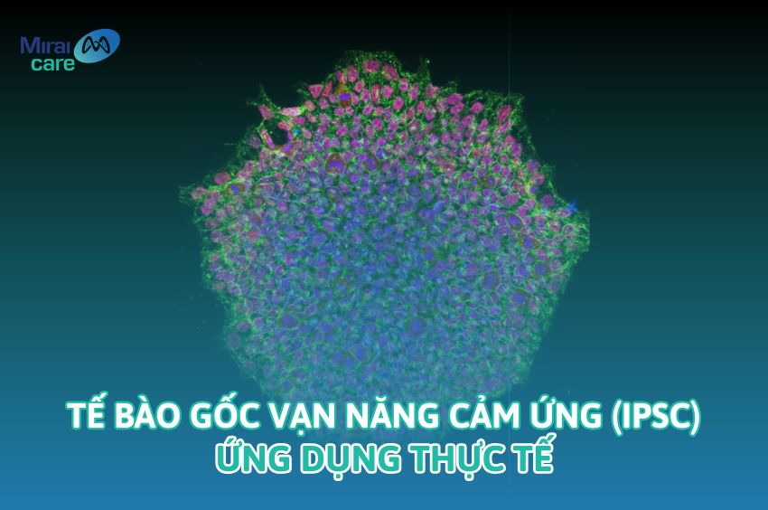 Tế b&agrave;o gốc