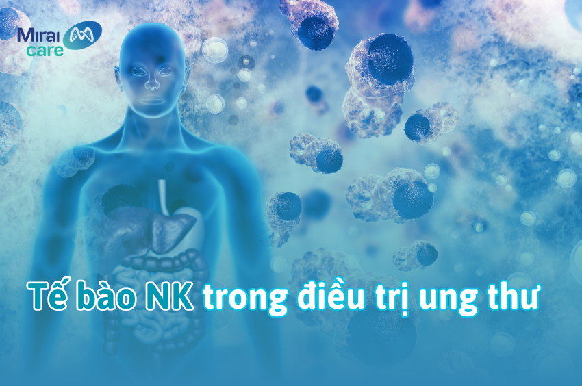 Ứng dụng liệu pháp tế bào NK trong điều trị ung thư