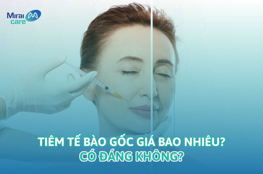 Tiêm tế bào gốc giá bao nhiêu? Có đáng không?