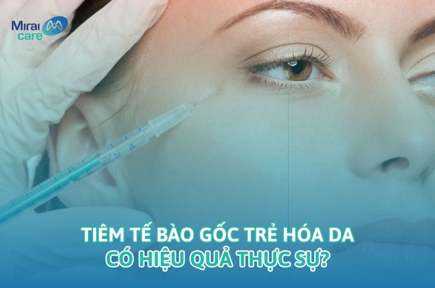 Tiêm tế bào gốc trẻ hóa da có hiệu quả thực sự?