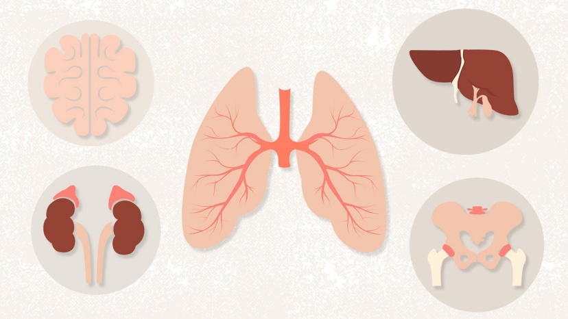 Ung thư phổi giai đoạn cuối sống được bao lâu ?